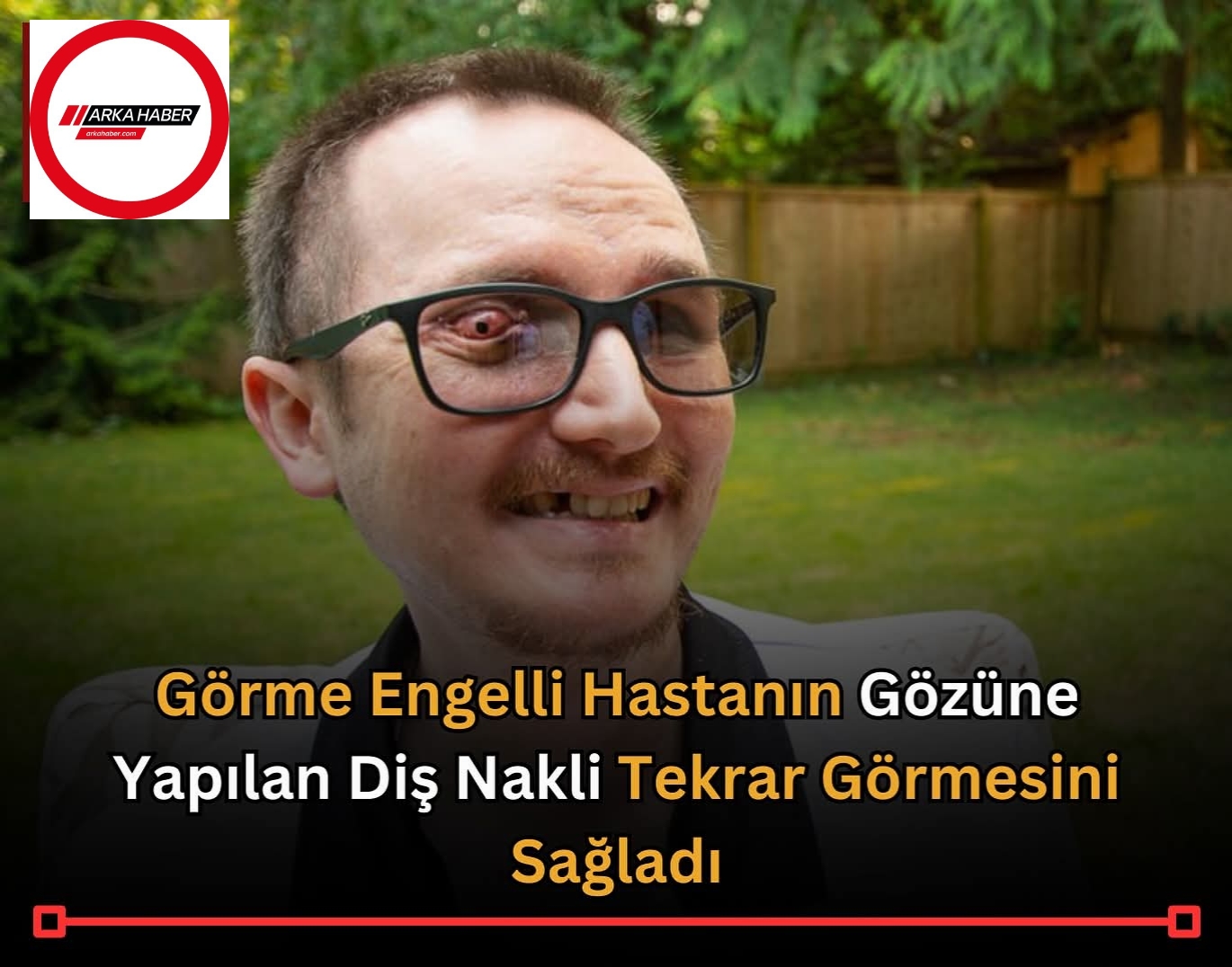 Görme Engelli Hastanın Gözüne Diş Nakli Yapıldı: 21 Yıl Sonra Tekrar Görmeye Başladı!