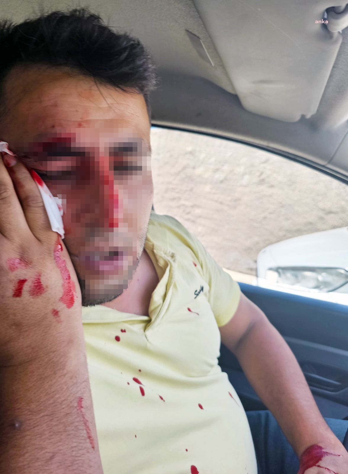 Şırnak’ta kaçak elektrik kontrolü yapan ekibe saldıran şüpheliler tutuklandı