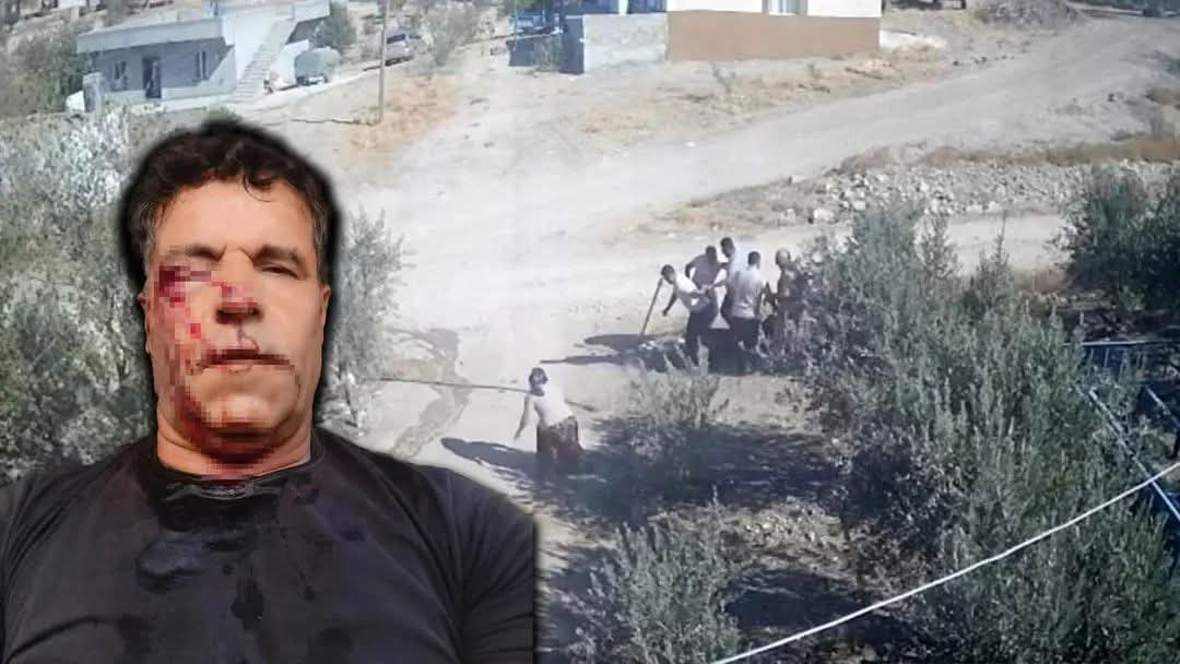 Şanlıurfa’da Su Kuyusu Kavgasında Kan Donduran Anlar: Eşinin Hayatını Taş Atarak Kurtardı!